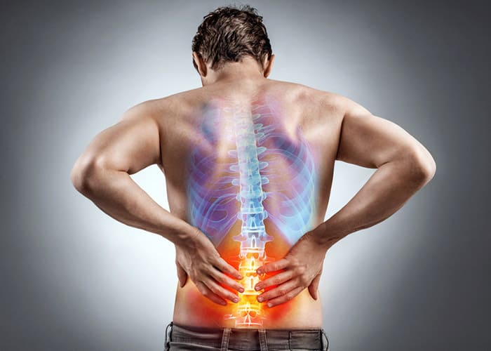 Frühe Physiotherapie hilft langfristig gegen Rückenschmerzen